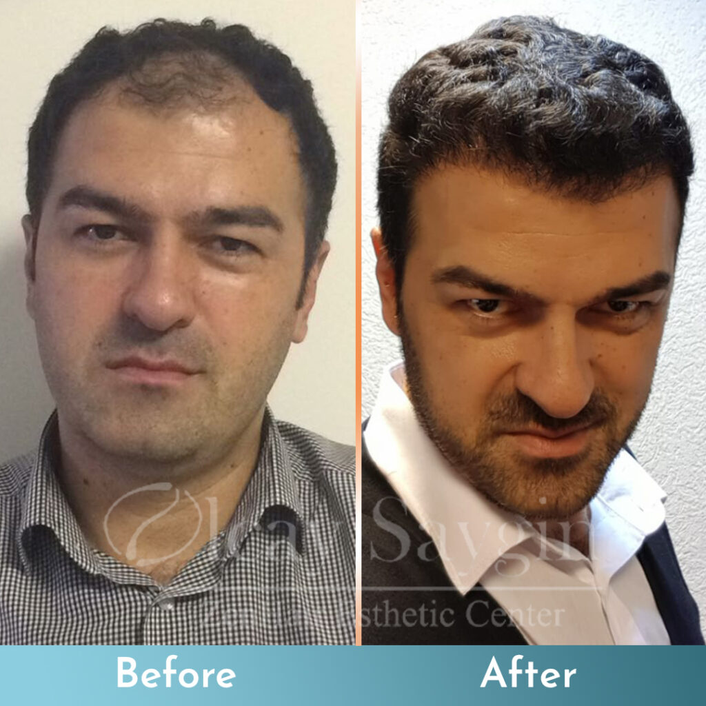 Gallery Image 43